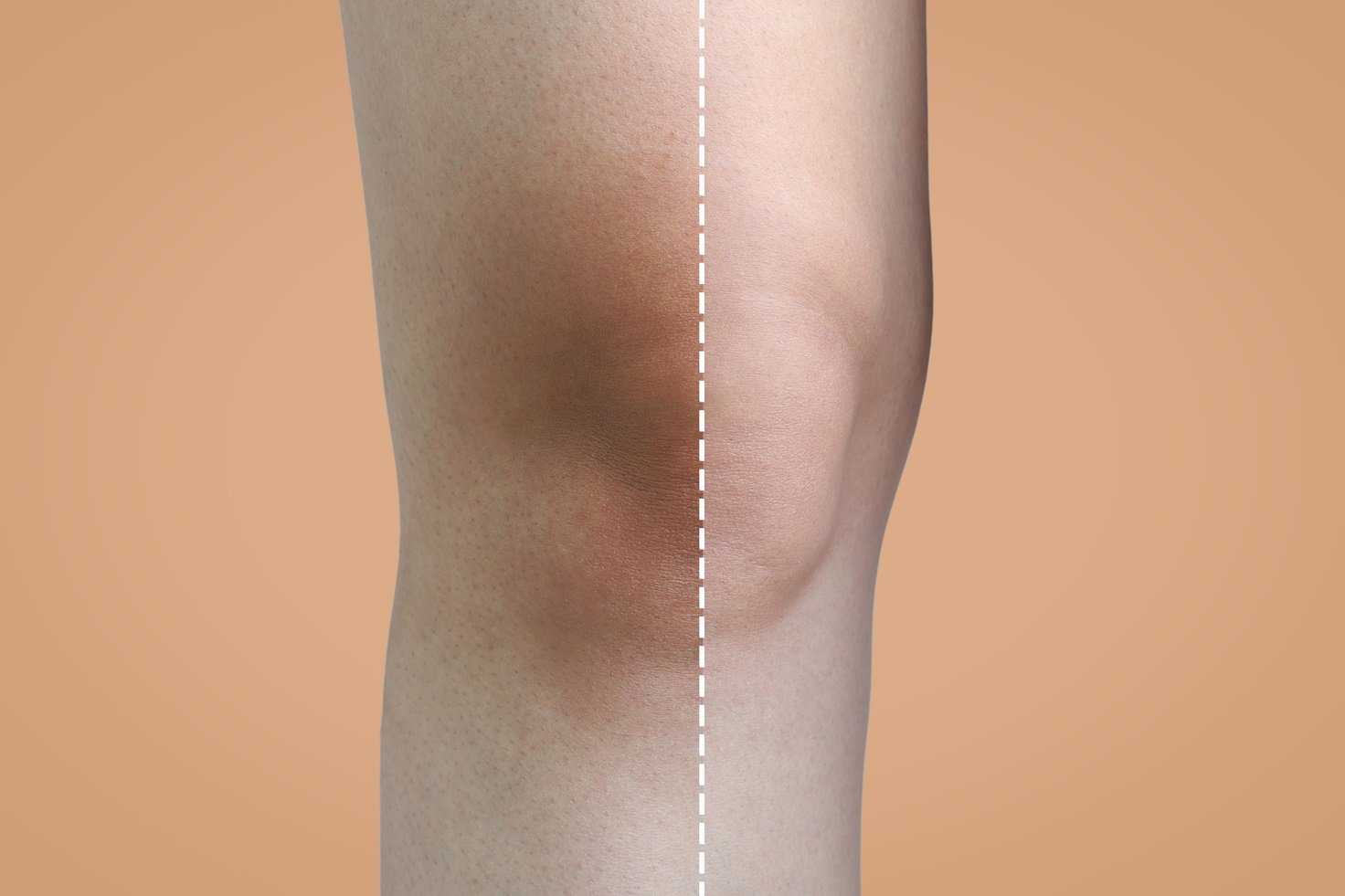 pigmentation